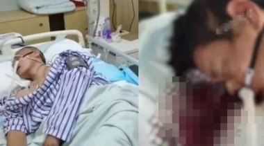 医生提醒热射病死亡率极高