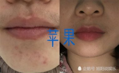 华为手机嘴唇怎么修