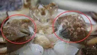 女子跟风生吃彩椒碗感染钩虫
