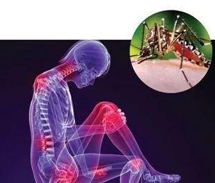 基孔肯雅热要做核酸吗