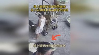 孩子后退时不小心摔进热锅