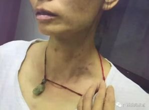 男子逼问妻子“是否出轨”并施暴