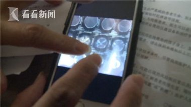 月嫂疏忽致29天婴儿重摔颅内出血