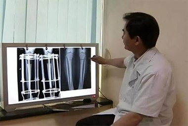 4次断骨打开折叠男孩迈出新生第一步