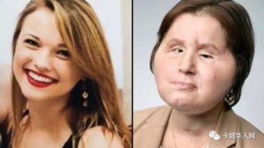 美国21岁模特在德国见义勇为被毁容